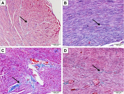 Figure 6 Effect of sitagliptin on collagen deposition in the heart of control and diabetic rats.