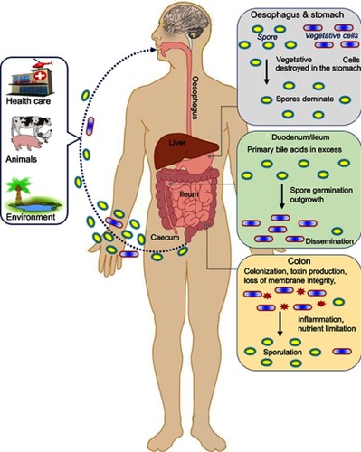 Figure 1 Infection cycle of toxigenic Clostridium difficile in the human gastrointestinal track. As C. difficile is an obligate anaerobic bacterium, transmission occurs primarily via spores. Three sources of infection (health care, animal and community residences) are indicated. Spores and some vegetative cells (most of which are eliminated in the hosts stomach) are ingested. Once past the stomach a range of metabolic factors (primary to secondary bile acid ratio, short chain fatty acids) encourages spore germination in the duodenum. After germination, the cells disseminate to the anaerobic folds of the ileum and cecum, forming colonies (assuming dysbiosis). Once in the colon, some cells enter sporulation, others produce toxins. As toxin levels increase, the epithelial barrier is challenged, this in turn initiates the inflammatory response and upregulates the production of anti-toxin antibodies in the host.