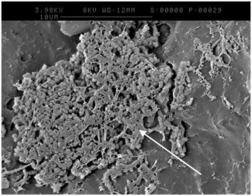 Figure 3. SEM image of a pumice treated sample following intubation demonstrating the formation of an extracellular matrix (highlighted by arrow).