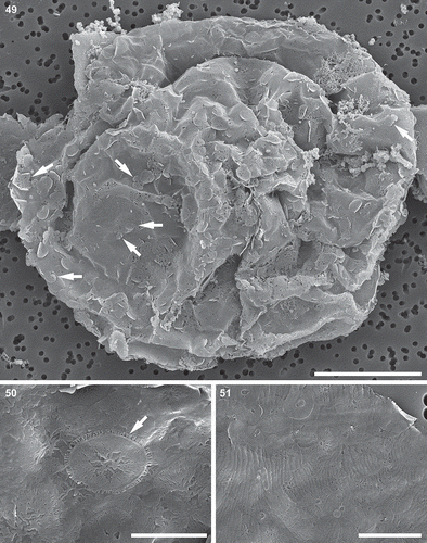 Figs 49–51. Auxospore, scanning electron microscopy. Fig. 49. A slightly collapsed, subglobular auxospore showing siliceous components of the cell wall. Arrows indicate scales with a variety of shapes. This figure is a digitally constructed montage of four individual SEM images. Fig. 50. Various incunabular scales in the outermost layer of the auxospore wall. Arrow indicates scale with pattern mimicking the ornamentation pattern of vegetative valves in some thalassiosiroid diatom species. Fig. 51. Perizonial bands overlaid by a layer of incunabular scales. Scale bars: Fig. 49, 20 µm; Fig. 50, 3 µm; Fig. 51, 5 µm.