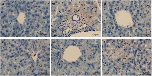 Figure 7. Effects of taraxasterol on hepatocyte apoptosis in Con A-induced acute hepatic injury (200×). The mice were treated with taraxasterol (10, 5 and 2.5 mg/kg, respectively) or Bif and injected a single dose of Con A. Hepatocyte apoptosis was observed under the optical microscope by TUNEL staining. (a) Normal group; (b) Con A group; (c) Bif + Con A group; (d) Taraxasterol 10 mg/kg + Con A group; (e) Taraxasterol 5 mg/kg + Con A group; (f) Taraxasterol 2.5 mg/kg + Con A group.