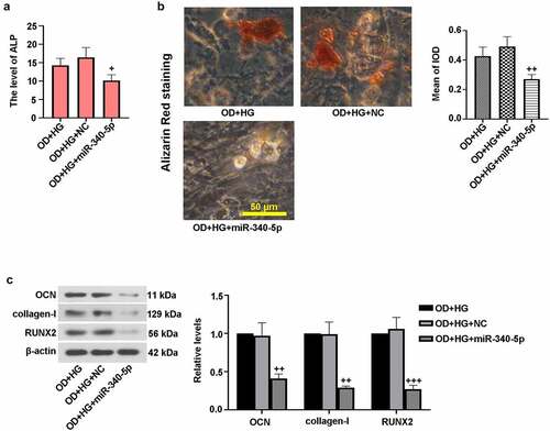 Figure 4. Up-regulation of miR-340-5p blocked osteogenic differentiation in MC3T3-E1 cells. MiR-340-5p was overexpressed (miR-340-5p) via lentivirus infection. Subsequently, osteoblast differentiation was induced, and cells were treated with HG for 14 days. (a) ALP activity was measured with the kit. (b) Treated cells were stained with Alizarin Red and quantified accordingly. Scale bar = 50 μm. (c) OCN, collagen-I, and RUNX2 protein levels were assessed with immunoblotting. Data were indicated as means ± SD (N = 3 per group). +P < 0.05, ++P < 0.01 and +++P < 0.001 versus OD+HG+NC group