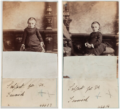 Figure 7 William Notman, Subject for Dr. Fenwick, 1877. Page from Picture Book. II-46617 and II-46618, McCord Museum, Montreal.