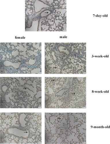 Figure 3 ACE2 expression in mouse lung tissues: as measured via immunohistochemical staining, brownish-yellow indicates the presence of ACE2 expression. Black arrow indicates that ACE2 brown staining deposition is mainly located in bronchial epithelium and alveolar epithelium. (×200).