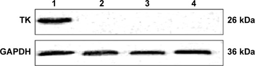 Figure 4 Western blot analysis of thymidine kinase (TK) protein expression. TK =26 kDa; GAPDH =36 kDa.Notes: Lane 1, blank control; lane 2, gene transfection-alone group; lane 3, the thermotherapy-alone group; lane 4, the combined therapy group.Abbreviation: GAPDH, glyceraldehyde 3-phosphate dehydrogenase.