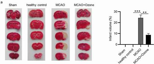 Figure 2. Ozone decreased cerebral infarction volume in MCAO model rats. (a).The cerebral infarcted area of rats in the Sham group, the healthy control group, the MCAO group and the MCAO + ozone group after TTC staining were shown. The percentage of cerebral infarcted area in total brain was also exhibited. N = 12 in each group. **p < 0.01, ***p < 0.001.
