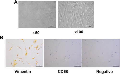 Figure 1 Isolation, culture and identification of fibroblast-like synoviocytes from rheumatoid arthritis (RA-FLS). (A) RA-FLS was isolated and cultured in vitro. (B) The selected RA-FLS was identified by Vimentin and CD68 immunohistochemistry.