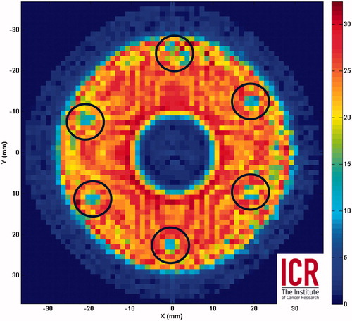 Figure 2. RMS voltage amplitude (mV) for a curved spherical bowl transducer surface scan using a fibre-optic sensor close (<3 mm) to the surface of a 64-mm diameter, 63-mm focal length, 1.7-MHz HIFU transducer. The scan reveals solder connections (circled) arranged hexagonally which have reduced output.