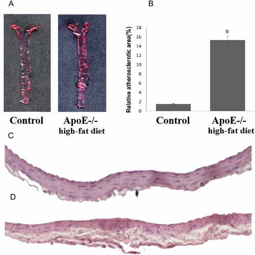 Figure 1. ApoE-/- mice fed with a high-fat diet exhibit a more pronounced atherosclerotic plaque. A: Oil Red O staining of atherosclerotic lesions in ApoE-/- mice fed with a high-fat diet and control mice. B: Quantitative lesion areas (Oil Red O positive) are calculated as a percentage of total aorta surface and presented as the mean ± standard deviation of the mean (%), *p < 0.05; There were three mice in each group. C: H&E stained transverse sections of the aortic arch in control (100×). D: H&E stained transverse sections of the aortic arch in ApoE-/- mice fed with a high-fat diet (100×)