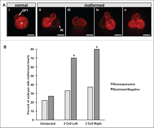 Figure 3. Overexpression and injection of dominant-negative HCN4 mRNA induces aberrant heart morphology. (A) Mature NF stage 46 tadpole hearts were visualized by immunohistochemistry using a cardiac troponin-T antibody to detect mature cardiac muscle. In control tadpoles, the ventricle (V) and outflow tract (OFT) are readily visible with the atria located directly behind the ventricle (i). Altering HCN4 expression induced a variety of morphological defects including hearts that were twisted into the dorso-ventral (D-V) body axis (ii), hearts rotated in the same plane of the D-V axis (iii), unlooped hearts (iv), and double ventricle phenotypes (v). In twisted hearts (ii) the atria are no longer positioned behind the ventricle and can now be seen (At = atria). (B) Both injection conditions of the HCN4-DN(AAA) construct induced significantly higher percentages of morphological defects compared with uninjected tadpoles, whereas overexpression of HCN4 did not cause significant occurrences of malformed hearts χ2 = 58.174, df = 4, * p < 0.05; n = 75 embryos per condition across 3 biological replicates.