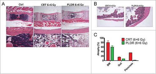 Figure 1. Pulsed Low Dose Rate Radiotherapy (PLDR) is associated with reduced levels of bone marrow and intestinal atrophy at equivalent doses of Conventional Radiotherapy (CRT). H/E staining shows cellular atrophy in the bone marrow (BM) (A) and the cecum (B) following treatment with CRT and PLDR. Morphometric quantitation using the NIH Image J software of atrophic areas in the BM, pancreas and intestine is shown (C). The arithmetic mean of a minimum of 5 analyzed tissue areas from 1–2 mice is shown. Error bars represent the standard error. BM, bone marrow.