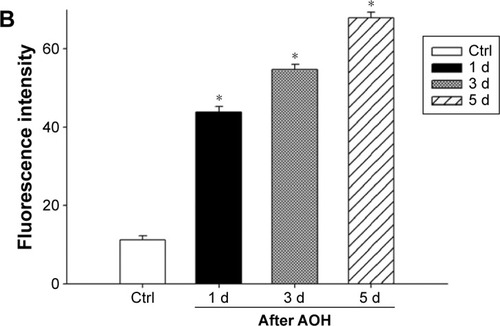 Figure 3 AAA attenuated induced Müller gliosis in the rat model of AOH.