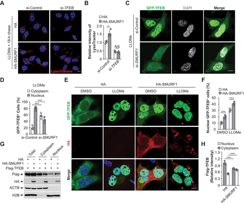 Figure 2. SMURF1 controls TFEB nuclear translocation. (A and B) HEK293 cells were transfected with siRNA against TFEB. After 48 h, cells were re-transfected with HA or HA-SMURF1 for another 24 h and chased for 18 h after LLOMe (1 mM, 1 h) washout, and then stained with LysoTracker and Hoechst (A). The quantification of LysoTracker’s relative intensity per cell is shown in (B). (C and D) HEK293 cells were transfected with SMURF1 or scramble siRNA oligos for 48 h, then transfected with GFP-TFEB for another 24 h. Cells were then fixed and stained with DAPI after the treatment of LLOMe (1 mM, 2 h) and visualized using confocal microscopy (C). The percentage of cells with GFP-TFEB in cytoplasm or nucleus respectively are shown in (D). (E and F) HEK293 cells were transfected with GFP-TFEB and HA or HA-SMURF1 for 24 h, and were treated with LLOMe (1 mM, 2 h) or DMSO before fixation and stained with DAPI and HA antibody (E). The percentage of cells with GFP-TFEB in nucleus is shown in (F). (G and H) HEK293 cells were transfected with Flag-TFEB with HA or HA-SMURF1 for 24 h, and then cells were harvested and carried out nuclear and cytoplasmic separation assay, and lysates were subjected to western blotting analysis using anti-Flag, anti-HA, anti-ACTB/β-actin and anti-H2B/histone 2B antibodies (G). The percentage of cells with Flag-TFEB in cytoplasm and nucleus are respectively shown in (H). Scale bar: 5 μm; n ≥ 50 cells per group. Data were from three independent experiments represented as means ± SEM. NS p > 0.05; *p < 0.05; ***p < 0.001.