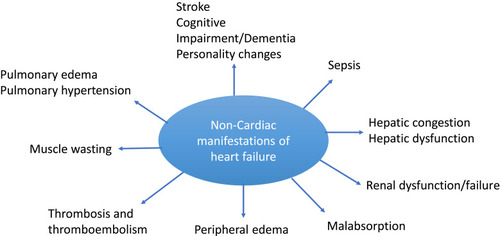 Figure 1 Non-cardiac complications of heart failure.