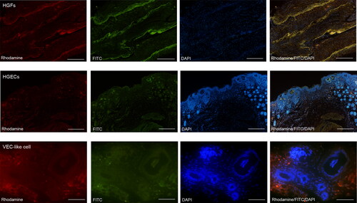 Figure 8. Immunofluorescence staining in vivo. HGFs are positive for cytoplasmic Vimentin, Rhodamine stains its cytoplasm with red, FITC stains its cytoplasm with green, and DAPI stains all nuclei with blue. Under the microscope, epithelial-like cells were abundant in the epithelial-like area, DAPI staind the nucleus blue, and the epithelioid-like tissue migrates with the normal epithelium of nude mice. In addition, the vascular cavity-like structures can be seen under the field of view of VEC-like cell.