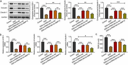 Figure 4. MMP13 overexpression attenuates the effects of PRRX1 knockdown on the barrier dysfunction of NCM460 cells challenged with DSS. (a and b) The expression of barrier dysfunction-related proteins, including ZO-1, occludin and claudin-1 was determined by Western blot analysis and reverse transcription-quantitative PCR. (c) The cellular permeability was evaluated by TEER. *P < 0.05, **P < 0.01 and ***P < 0.001. PRRX1, paired related homeobox 1; ZO-1, Zonula occludens-1.