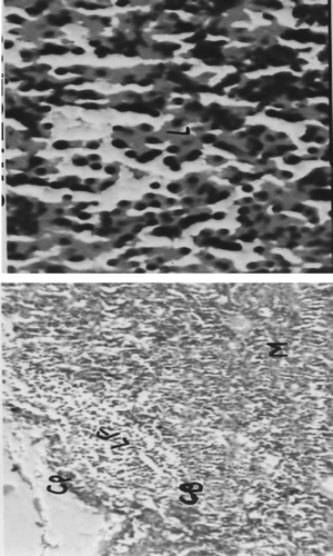 FIG. 4C Representative photomicrograph of axillary lymph node tissues recovered from rats on Day 22 of the respective indicated treatment regimens (C = Cortex, CP = Capsule, M = Medulla, and LF = Lymphoid follicles)—Dexamethasone-treated rats. Left image at 10×, Right image at 40×.