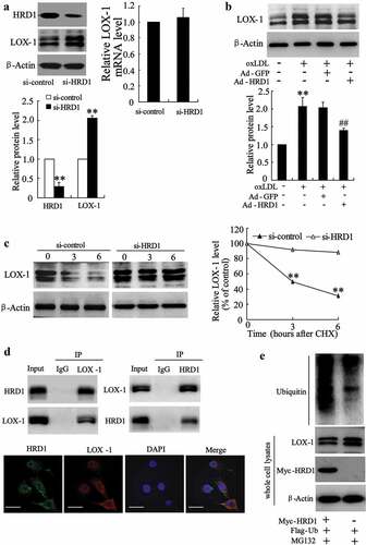 Figure 4. HRD1 promotes LOX-1 ubiquitination for degradation. (a) The expression of HRD1 and LOX-1 in si-HRD1 transfected human umbilical vein endothelial cells (HUVECs) was measured by immunoblotting. (b) HUVECs were transfected with Ad-GFP or Ad-HRD1 for 24 h, followed by exposure to ox-LDL (80 μg/ml) for 24 h and measurement of LOX-1 expression. (c) HUVECs were transfected with si-HRD1 or si-control for 48 h, followed by exposure to cycloheximide (CHX 50 mg/ml) for 0, 3, or 6 h and measurement of the LOX-1 protein levels in whole cell lysates by immunoblotting. The intensity of the LOX-1 protein bands was analyzed by densitometry, after normalization to the corresponding β-Actin level. (d) HUVECs were pretreated with MG132 (10 μM) for 6 h, followed by determination of endogenous protein-protein interactions between HRD1 and LOX-1 by immunoprecipitation (IP) with HRD1 or LOX-1 antibodies and subsequent immunoblotting. IgG was used as a negative control for IP. HUVECs were stained with Hrd1 (green) and LOX-1 (red). HRD1 and LOX-1 merged appear as orange/yellow. Bar = 10 μm. (e) Ubiquitination of LOX-1 was induced by HRD1. Flag-ubiquitin was coexpressed in HUVECs with myc-HRD1 or vector control with treatment with MG132 (10 μmol/l) for 6 h. Ubiquitinated LOX-1 protein was immunoprecipitated using Flag-Tag antibody and further detected with Anti-LOX-1 antibody. The endogenous levels of LOX-1 and myc-HRD1 in the whole cell lysates were examined by anti-LOX-1 and anti-myc antibodies. Values are means ± SD and are representative of three individual experiments. **P < 0.01, compared to si-control. ##P < 0.01, compared to ox-LDL + Ad-GFP.