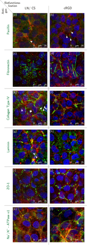 Figure 4. Immunocytochemical staining of HCEC before detachment; HCEC were cultured for eight days on PVME50–PNiPAAm40–PVMEMA10 carriers functionalized with LN/CS or cRGD. (a), (b) Dot-shaped paxillin signals (white arrowheads). (c), (d) Fibronectin fibers. (e), (f) Fine collagen type IV fibers (white arrowheads) and aggregated collagen type IV. (g), (h) Few fine laminin fibers (white arrowheads) and mostly aggregated laminin signals. (i), (j) ZO-1 localized to the lateral cell membranes. (k), (l) Strong Na+/K+-ATPase α1 signals associated to the lateral cell membranes. Antigens of interest are shown in green (Alexa Fluor®488), F-actin fibers in red (Phalloidin) and the nuclei in blue (Hoechst). n = 3.