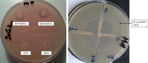 Figure 3 Carbapenem-resistant phenotypes. The left photograph shows the DDST for MBL production, and the right photograph displays the MHT for carbapenemase production.