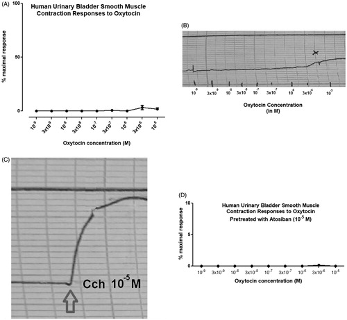 Figure 1. The contractile responses of the human urinary bladder smooth muscle strips to oxytocin without (a, b) or with atosiban (d) and carbachol (c) in isolated in-vitro organ bath. A- Cumulative oxytocin concentration-response curves for all human urinary bladder strips. B- Cumulative concentration response of patient ID: 2 (the only responsive tissue) in 10−6 M concentration. C- Carbachol concentration-response to 10−5 M (functionality test). D- Cumulative concentration response of the human urinary bladder smooth muscle strips to oxytocin pretreated with 10-5 M atosiban (Y axis is 10%).