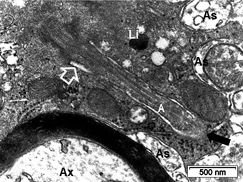 Figure 9. ODS12h oligodendrocyte aspect of Figure 8 primary cilium. A: Axoneme where the tip microtubule ends (arrow) appears ‘cut’ by the endocytic formed structure due to the sectioning angle. The open arrow indicates the narrow, demarcated cilium pocket formed by fusing coated vesicles near its shaft region. Note the contrasted cytoplasm with scattered ribosomes and mitochondria profiles. As: Astrocyte; Ax: Axon and its myelin