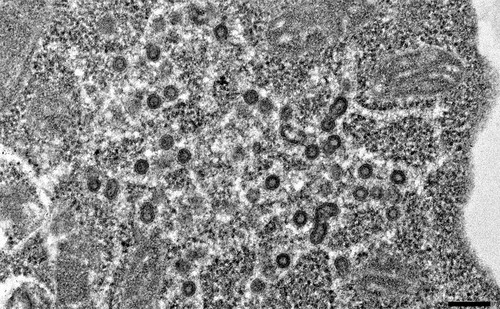 Figure 2. Retrovirus-like viral particles in the cytoplasm of murine cells. The cells were prepared and imaged with tsTEM. Scale bar = 200 nm.