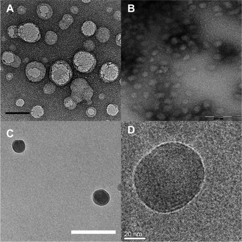 Figure 2 TEM of ELP nanoparticles. Diblock copolymers composed of ELPs with various guest residues assemble micelles.Notes: (A) TEM image of A96I96, which has a hydrophilic (Xaa = Ala, n=96, N-terminus) and a hydrophobic (Xaa = Ile, n=96, C-terminus) block. Scale bar 50 nm. From Janib SM, Liu S, Park R, et al. Kinetic quantification of protein polymer nanoparticles using non-invasive imaging. Integr Biol (Camb). 2013;5(1):183–194.Citation23 Reproduced by permission of The Royal Society of Chemistry. (B) TEM image of ELP I96S96, which has a hydrophilic (Xaa = Ser, n=96, C-terminus) and a hydrophobic (Xaa = Ile, n=96, N-terminus) block. Scale bar 200 nm. From Janib SM, Pastuszka MF, Aluri S, et al. A quantitative recipe for engineering protein polymer nanoparticles. Polym Chem. 2014;5(5):1614–1625.Citation4 Reproduced by permission of The Royal Society of Chemistry. (C) Cryo-TEM image of ELP E50I60, which has a hydrophilic (Xaa = Val:Glu [4:1], n=50, N-terminus) and a hydrophobic (Xaa = Ile, n=60, C-terminus) block. Scale bar 100 nm. Reproduced with permission from García-Arévalo C, Bermejo-Martín JF, Rico L, et al. Immunomodulatory nanoparticles from elastin-like recombinamers: single-molecules for tuberculosis vaccine development. Mol Pharm. 2013;10(2):586–597.Citation34 Copyright 2013 American Chemical Society. (D) Cryo-TEM image of ELP-96/90, which has a hydrophilic (Xaa = Val:Ala:Gly [1:8:7], n=96, N-terminus) and a hydrophobic (Xaa = Val, n=90, C-terminus) block. Scale bar 20 nm. Reprinted with permission from Dreher MR, Simnick AJ, Fischer K, et al. Temperature triggered self-assembly of polypeptides into multivalent spherical micelles. J Am Chem Soc. 2008;130(2):687–694.Citation33 Copyright 2008 American Chemical Society.Abbreviations: ELP, elastin-like polypeptide; TEM, transmission electron microscopy; cryo-TEM, cryogenic transmission electron microscopy.