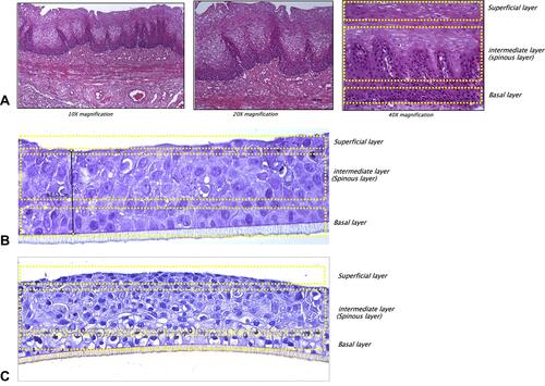 Figure 1 H&E staining of healthy human female oesophageal biopsy (A), human reconstructed oesophageal epithelium after 5 days of differentiation (B) and after 12 days of differentiation (C). The yellow dashed rectangles underline the location of the different cell layers present both in the human explant and in the 3D reconstructed tissue.