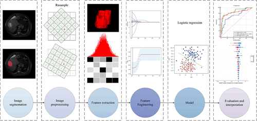 Figure 2 The general flow of radiomics analysis in this study.