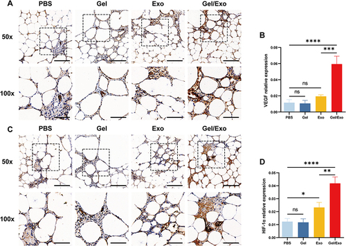 Figure 8 Histochemical analysis of VEGF and HIF-1α expression in the harvested fat. (A) Representative immunohistochemical staining images of VEGF at 8 weeks post-fat grafting. Scale bar: 200 μm, 100 μm. (B) Quantitative analysis of the relative expression of VEGF at 8 weeks post-fat grafting. (C) Representative immunohistochemical staining images of HIF-1α at 8 weeks post-fat grafting. Scale bar: 200 μm, 100 μm. (D) Quantitative analysis of the relative expression of HIF-1α at 8 weeks post-fat grafting. Data are presented as the mean ± SD of three replicates. *p < 0.05, **p < 0.01, ***p < 0.001, ****p < 0.0001.