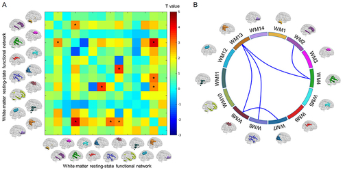 Figure 4 (A) Differences in functional connectivity within WM-FNs between good sleepers and poor sleepers. The color bar shows T value of two sample t-test. *Represents significant difference after FDR correction. (B) Five pairs of WM-FNs that showed significant difference in functional connectivity between good sleepers and poor sleepers.