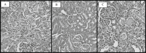 Figure 4. Light photomicrographs of the rats kidney sections (H&E × 400). Kidney sections from (A) control group with normal renal morphology, (B) I/R group with severe renal tubular necrosis, and (C) the group treated with dietary ginger prior to I/R process shows relatively well-preserved architecture with focal tubular necrosis.