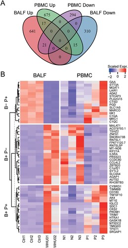 Figure 6. Comparison of differentially expressed genes in BALF and PBMC. (A) Venn diagram showing the number of changed genes with same or different trends between BALF and PBMC samples. (B) Heat map depicting the scaled gene expression changes with same or different trends between BALF and PBMC samples.