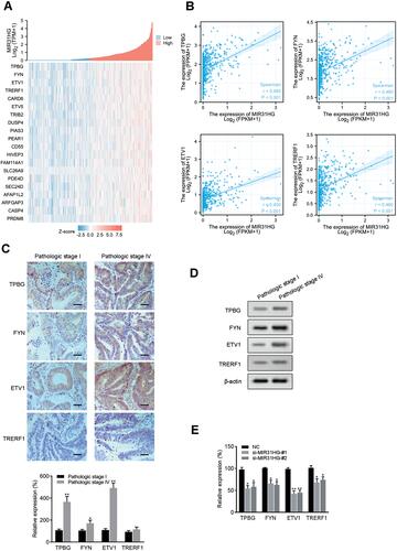 Figure 7 Association between MIR31HG expression and related genes. (A) Relationship between MIR31HG and the related genes were shown in a heatmap. (B) The expression correlation between MIR31HG and the selected genes were analyzed. (C) Representative images of immunohistochemistry showing MIR31HG-associated genes for distinct pathologic stages in colorectal cancer tissues (n=5 for each group). Scale bars, 50 μm. *P<0.05, **P<0.01 compared with pathologic stage I in colorectal cancer tissues. (D) Western blot analysis was performed to determine the expression of TPBG, FYN, ETV1 and TRERF1. (E) The expression of select genes was quantified by qRT-PCR in MIR31HG-silenced HT-29 cells. *P<0.05, **P<0.01 compared with negative control.