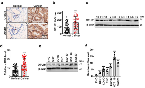 Figure 1. OTUB1 upregulation was found in the CRC cancer samples. (a-b) IHC staining and semi-quantitive study on OTUB1 protein expression in tumor samples of CRC patients and matched normal samples (100X). (c-d) WB/qRT-PCR investigation of OTUB1 protein and mRNA expression in CRC tumor samples and matched normal samples. (e-f) WB/qRT-PCR investigation of OTUB1 protein and mRNA expression in CRC cancer cell lines and normal mucosa cell line. *** p < 0.001 compared with group normal or FHC.