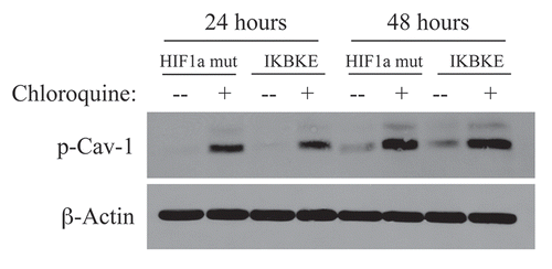 Figure 2 Chloroquine rescues the expression of phospho-Cav-1 (pY14) in activated HIF1a and IKBKE transfected fibroblasts. hTERT-BJ1 fibroblasts recombinantly expressing activated HIF1a or IKBKE were incubated with chloroquine for 24 or 48 hours and then subjected to immunoblot analysis with antibodies directed against phospho-Cav-1 (pY14). Note that treatment with chloroquine rescues the expression of phospho-Cav-1 (pY14) in both fibroblast cell lines. Immunoblotting with beta-actin is shown as a control for equal loading.