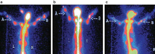 Figure 5. Radionuclide bone imaging photo of group A: (a) at 4th week; (b) at 8th week; (c) at 12th week, respectively.
