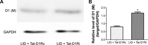 Figure 5 Effects of intrastriatal administration of Tat-D1Ri on membrane D1R subunit expression.