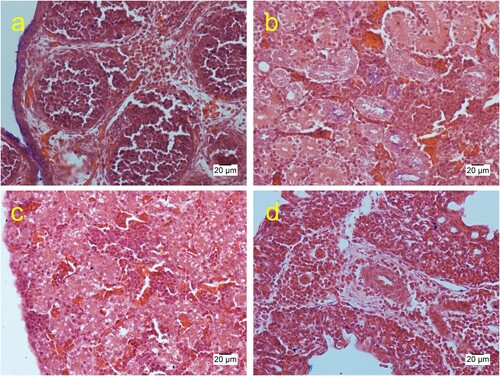 Figure 4. Histological sections of the late mortality embryos showing congestion and interstitial granulocytic infiltration in the bursa of Fabricius (a), kidney (b), liver (c), and the lung (d) (haematoxylin & eosin).