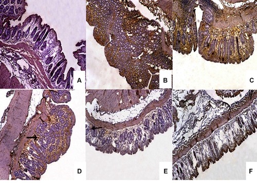 Figure 10 Microphotographs of rabbit’s colon sections using immunohistochemical staining for TNF-α localization.