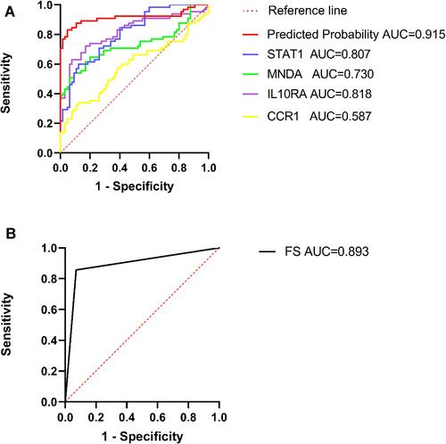 Figure 6 The single and combined diagnostic performance of the four genes. The diagnostic performance of FS (A). The diagnostic performance based on the IOD of four genes in SS patients (B). An AUC > 0.8 indicated that the predicted model had good efficacy.