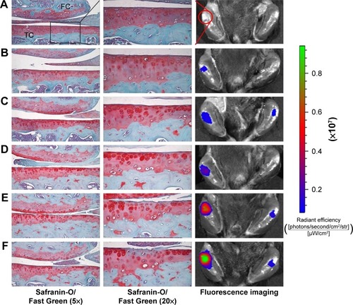 Figure 5 Histopathology and IVIS scanned images of DMM mouse knee joints.Notes: (Left) Whole knee joint images, (middle) tibial plateau images, and (right) IVIS imaging of the mouse after injection of targeted nanosomes. Sections of the knee joint were stained with Safranin-O/Fast Green and evaluated histopathologically (left and middle). (A) Sham and (B–F) mice in different stages of development of surgically induced arthritis as described in Table 1. Distinct increases in IVIS fluorescence intensity can be observed as the severity of arthritis increased from A to F. ROI quantification calculated as radiant efficiency.Abbreviations: DMM, destabilization of the medial meniscus; FC, femoral condyle; ROI, region of interest; TC, tibial condyle.