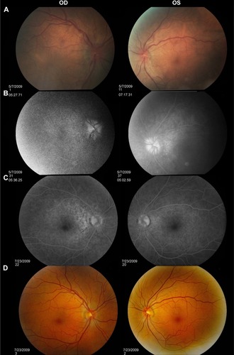 Figure 2 FA studies of Case 1.