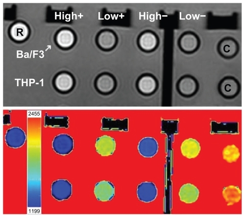 Figure 5 Upper panel shows signal intensity of incubated cell samples (repetition time = 1000 milliseconds, echo time = 20 milliseconds). The first row is Ba/F3 and the second row is THP-1. Columns labeled “high” are treated with 2.0 mM gadolinium and “low” with 0.5 mM gadolinium. Columns labeled with “+” are protamine sulfate treated and with “−” are not treated with protamine sulfate. The rightmost samples (labeled C) are cell control samples with no particles. Sample labeled R is Gd-diethylene triamine pentacetic acid reference (0.1 mM gadolinium in water). Bottom panel shows corresponding T1 map, which shows different colors corresponding to different T1 times.