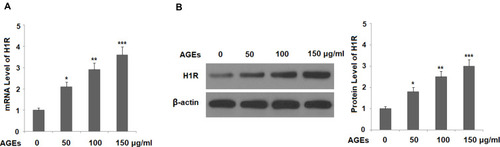 Figure 1 Advanced glycation end products (AGEs) increased the expression of the histamine H1 type receptor (H1R) in human SW1353 chondrocytes. Cells were stimulated with AGEs at 50, 100, and 150 μg/mL for 24 h. (A) mRNA of H1R; (B) Protein of H1R (*P<0.01 vs vehicle group; **P<0.001 vs vehicle group; ***P<0.0001 vs vehicle group).
