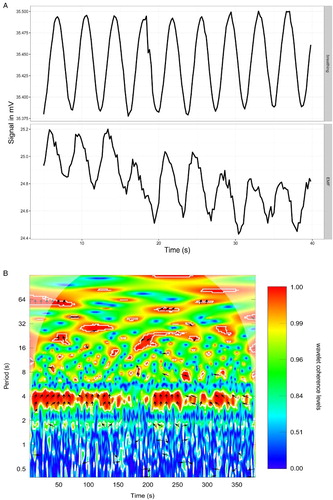 Figure 4 (A) Alignment between raw data from oxygenation sensor in breathing air (upper panel) and the redox potential difference between arterial and venous blood (lower panel). The oxygenation data increase with inhalation and decrease with exhalation. (B) Wavelet coherence analysis of oxygenation signal and redox potential. Areas delineated by white contour are areas with significance level of 0.1. Arrows indicate phase difference and are placed in areas of P-value of 0.05 or lower.