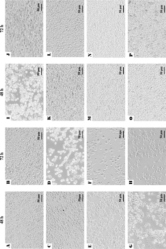 Figure 1.  Morphology of RAW264.7 cells cultured for 48 and 72 h after the addition of Dulbecco's modified Eagle's medium only (A and B), lipopolysaccharide at 1 µg/mL (C and D), whole cell (100 µg/mL) of Lactobacillus paracasei subsp. paracasei NTU 101 (E and F) and Lactobacillus plantarum NTU 102 (G and H), precipitate (100 µg/mL) of L. paracasei subsp. paracasei NTU 101 (I and J) and L. plantarum NTU 102 (K and L), and supernatant (100 µg/mL) of L. paracasei subsp. paracasei NTU 101 (M and N) and L. plantarum NTU 102 (O and P). Scale bar: 50 µm.