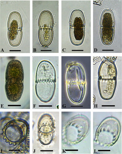 Figure 2. Light microscope images of Actinodontum lomaense cells from the Drakensberg escarpment. Scale bars = 20 µm.