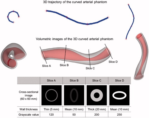 Figure 3. A 3 D curved arterial phantom containing varying cross-sectional shapes, wall thicknesses and grayscale values.